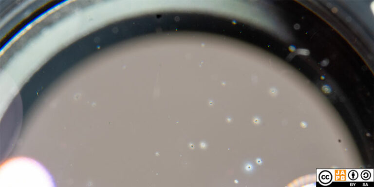 Lens defects, part II: Fungus – JAPB
